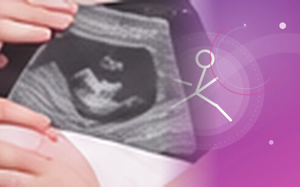 Antenatal Exercises medical care illustration, Aarunya Clinic Noida