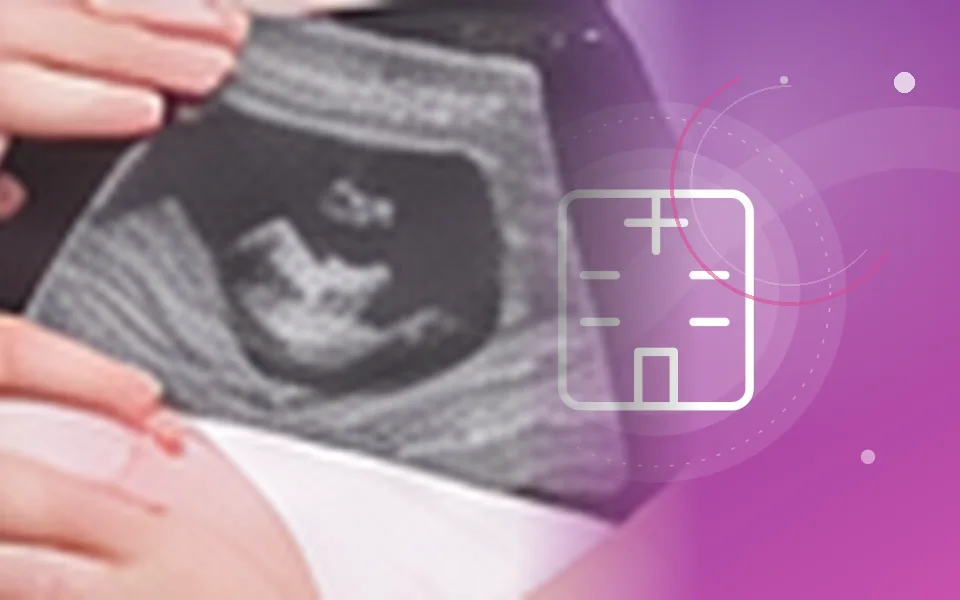 Caesarean Section medical care illustration, Aarunya Clinic Noida