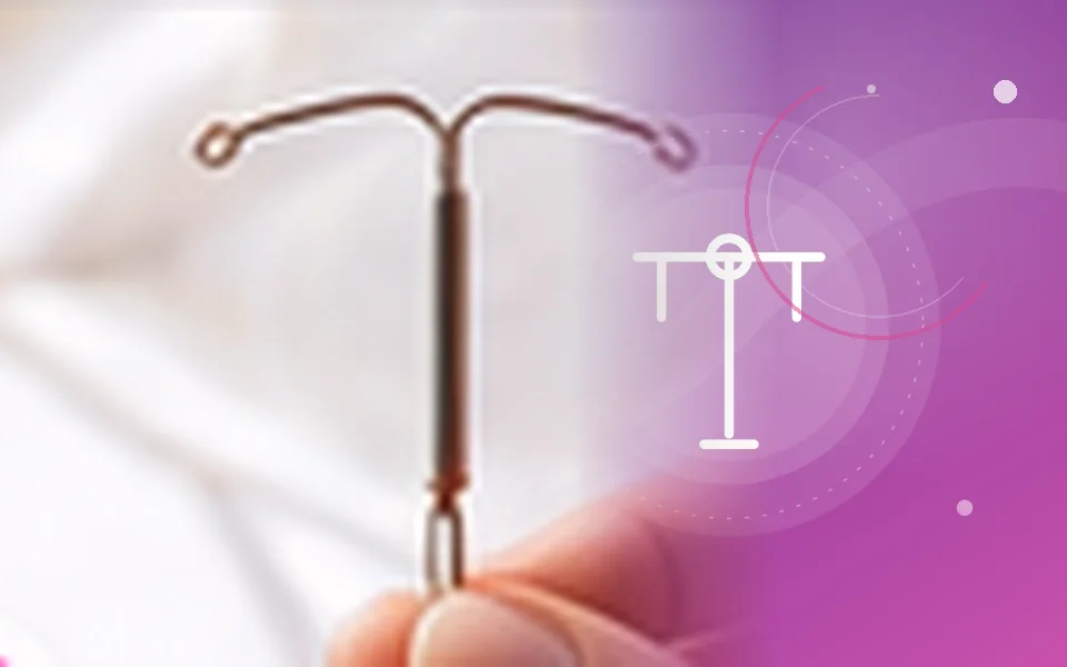 IUCD / CuT / Mirena Insertion or Removal medical care illustration, Aarunya Clinic Noida